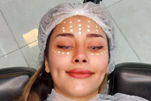 بی بی گلو کاور