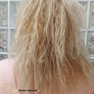 بستر سازی کراتینه